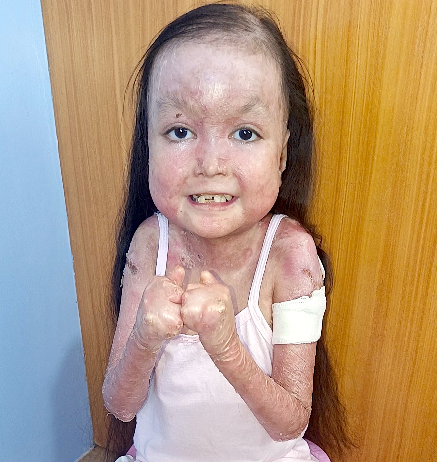 Please Donate to Stop Shamila's Severe Pain and Help Save Her Life — photo 3