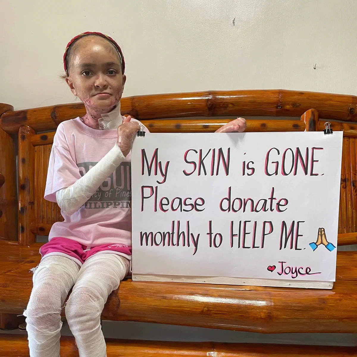 Please Help Reduce Baby Joyce's Severe Pain — photo 2