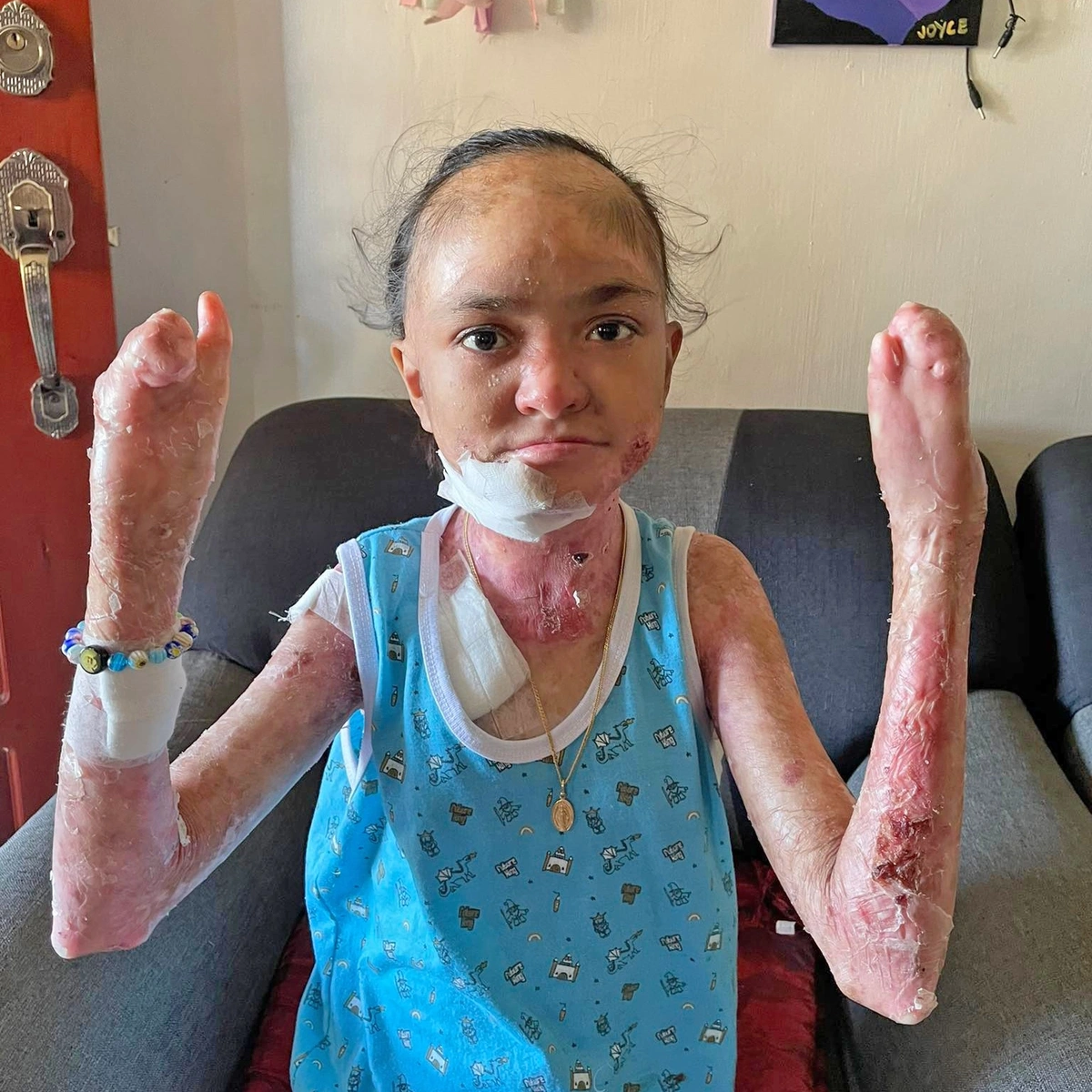 Please Help Reduce Baby Joyce's Severe Pain — photo 3