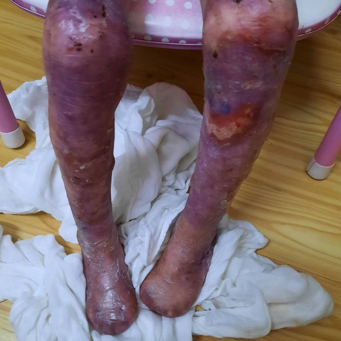 Please Donate to Stop Lily's Severe Pain and Help Save Her Life — photo 4